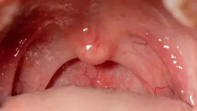 Blízký pohled na anatomii lidského hltanu s viditelným měkkým patrem a ústním štěbem.