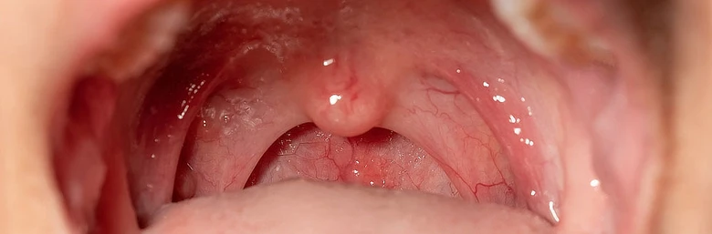 Blízký pohled na anatomii lidského hltanu s viditelným měkkým patrem a ústním štěbem.