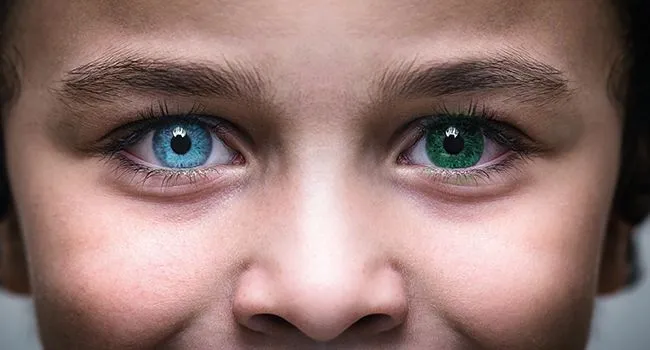 Dětské oči s různobarevnými duhovkami ukázající heterochromii.