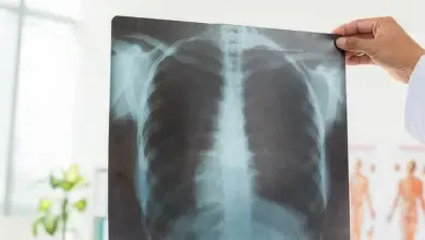 Rentgen hrudníku ukazující plicy a kosti dýchací soustavy
